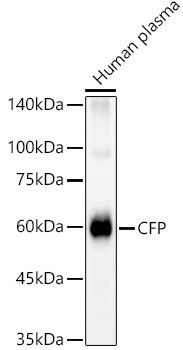 Properdin Antibody in Western Blot (WB)