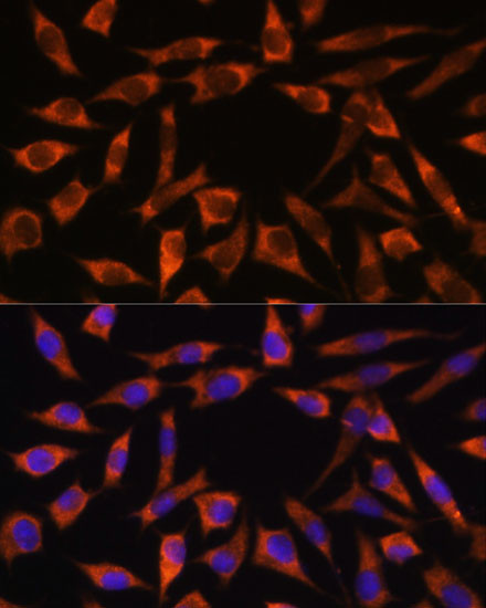 CHCHD2 Antibody in Immunocytochemistry (ICC/IF)