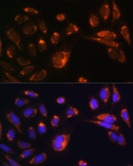 CHCHD2 Antibody in Immunocytochemistry (ICC/IF)