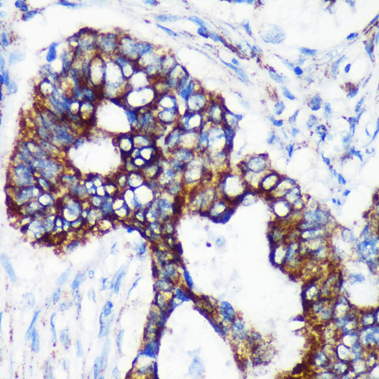 CHCHD2 Antibody in Immunohistochemistry (Paraffin) (IHC (P))