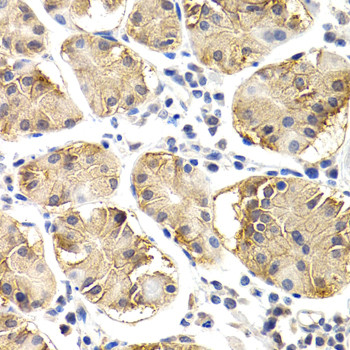 CHIT1 Antibody in Immunohistochemistry (Paraffin) (IHC (P))