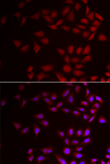 CIRBP Antibody in Immunocytochemistry (ICC/IF)