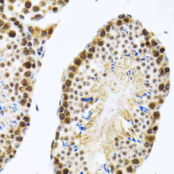 CIRBP Antibody in Immunohistochemistry (Paraffin) (IHC (P))