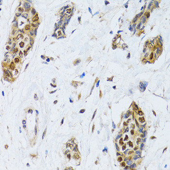 CIRBP Antibody in Immunohistochemistry (Paraffin) (IHC (P))