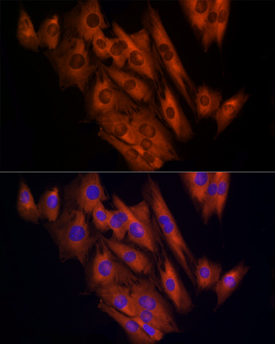 CLIC1 Antibody in Immunocytochemistry (ICC/IF)