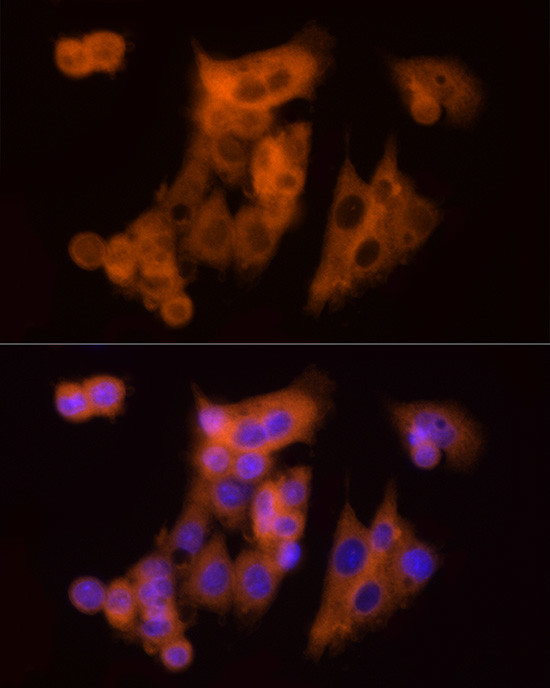 CLIC1 Antibody in Immunocytochemistry (ICC/IF)