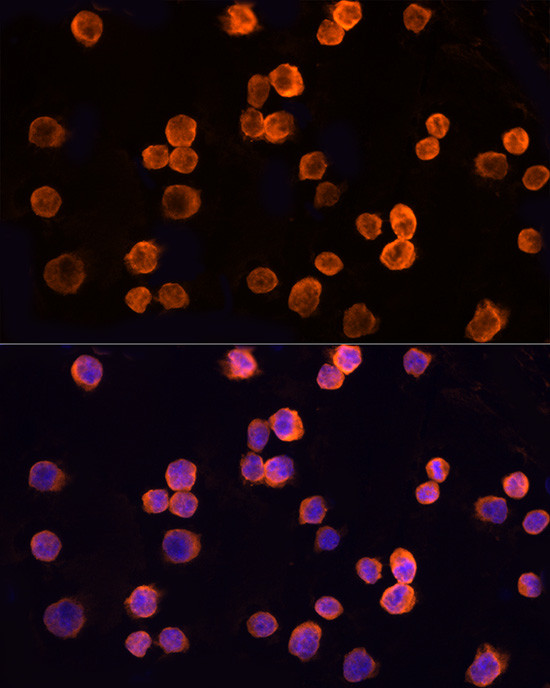 CLIC1 Antibody in Immunocytochemistry (ICC/IF)