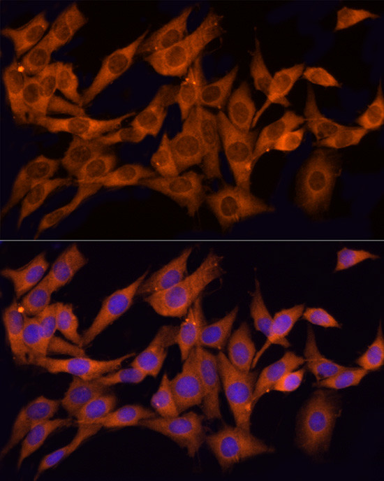 CLIC1 Antibody in Immunocytochemistry (ICC/IF)