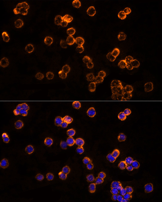 CLIC1 Antibody in Immunocytochemistry (ICC/IF)