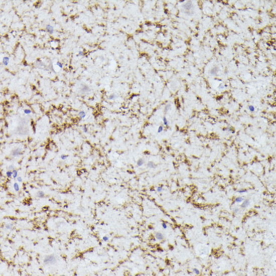 CLN8 Antibody in Immunohistochemistry (Paraffin) (IHC (P))