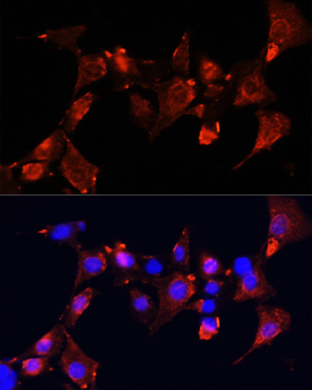 CLUH Antibody in Immunocytochemistry (ICC/IF)