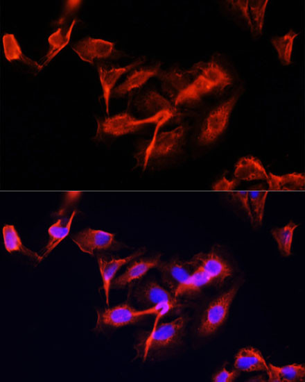 CLUH Antibody in Immunocytochemistry (ICC/IF)