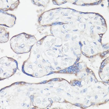 CLUH Antibody in Immunohistochemistry (Paraffin) (IHC (P))