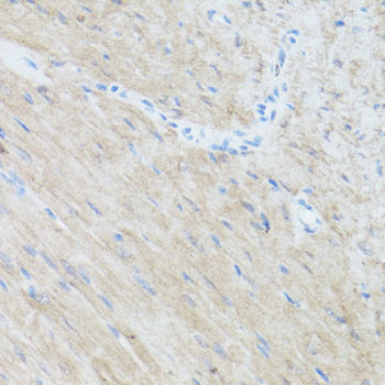 CLUH Antibody in Immunohistochemistry (Paraffin) (IHC (P))