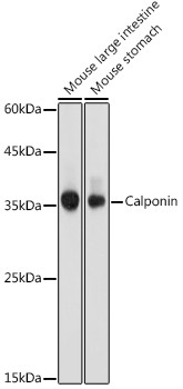 Calponin 1 Antibody in Western Blot (WB)