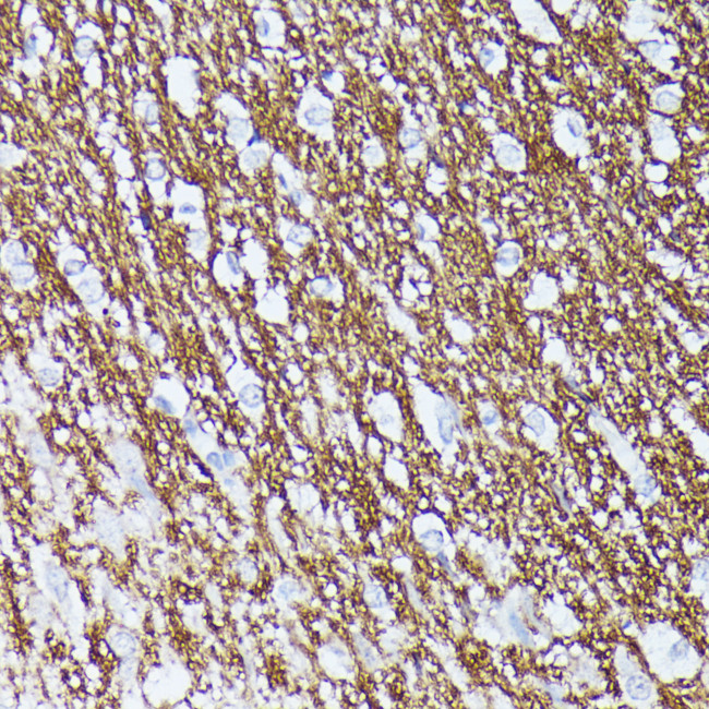 CNTN1 Antibody in Immunohistochemistry (Paraffin) (IHC (P))