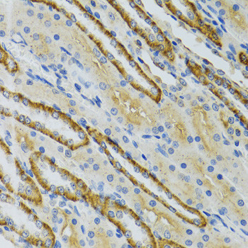 COG2 Antibody in Immunohistochemistry (Paraffin) (IHC (P))