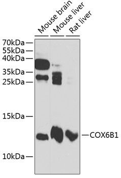 COX6B1 Antibody in Western Blot (WB)