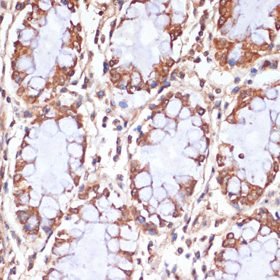 CPT1B Antibody in Immunohistochemistry (Paraffin) (IHC (P))