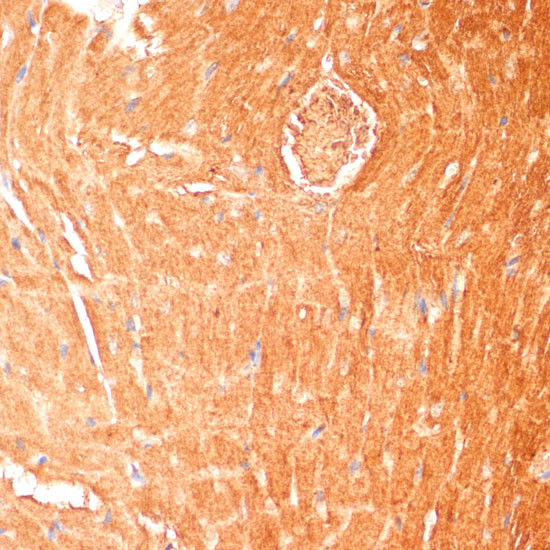 CPT1B Antibody in Immunohistochemistry (Paraffin) (IHC (P))