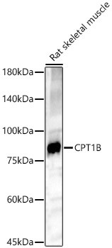 CPT1B Antibody in Western Blot (WB)