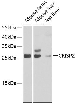 CRISP2 Antibody in Western Blot (WB)