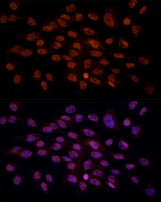 CRYGC Antibody in Immunocytochemistry (ICC/IF)