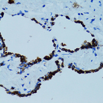 Cathepsin E Antibody in Immunohistochemistry (Paraffin) (IHC (P))