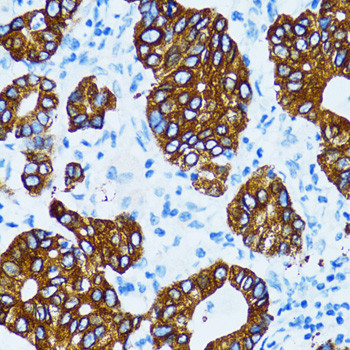 Cathepsin E Antibody in Immunohistochemistry (Paraffin) (IHC (P))