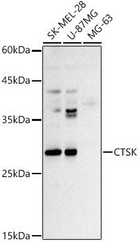 Cathepsin K Antibody in Western Blot (WB)