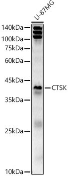 Cathepsin K Antibody in Western Blot (WB)