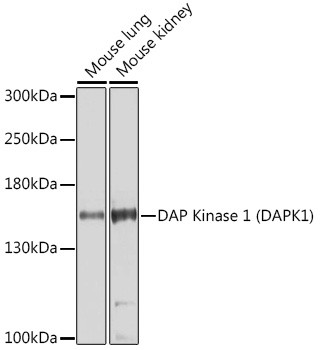 DAPK1 Antibody in Western Blot (WB)