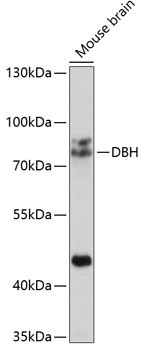 Dopamine beta Hydroxylase Antibody in Western Blot (WB)
