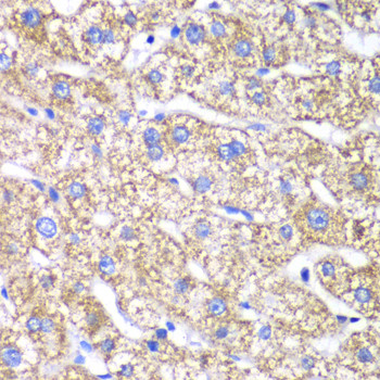 DLST Antibody in Immunohistochemistry (Paraffin) (IHC (P))