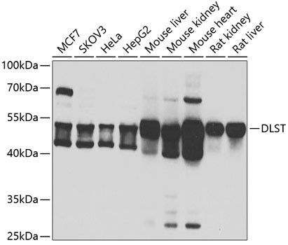 DLST Antibody in Western Blot (WB)