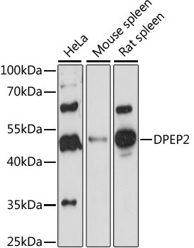 DPEP2 Antibody in Western Blot (WB)