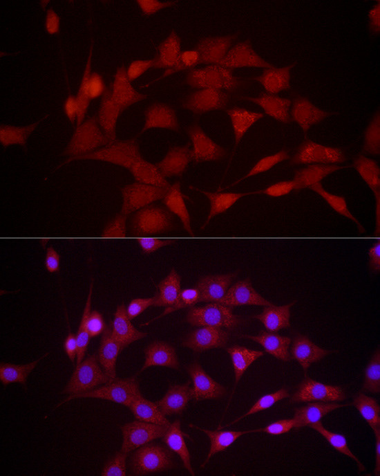 DUSP8 Antibody in Immunocytochemistry (ICC/IF)