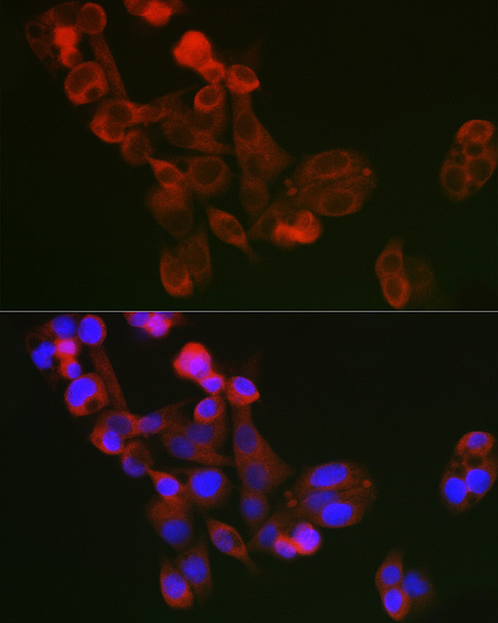 ECM1 Antibody in Immunocytochemistry (ICC/IF)