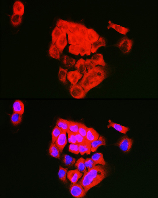 ECM1 Antibody in Immunocytochemistry (ICC/IF)