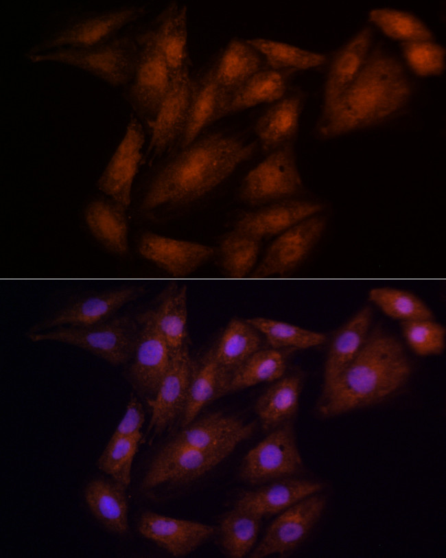 ECSIT Antibody in Immunocytochemistry (ICC/IF)