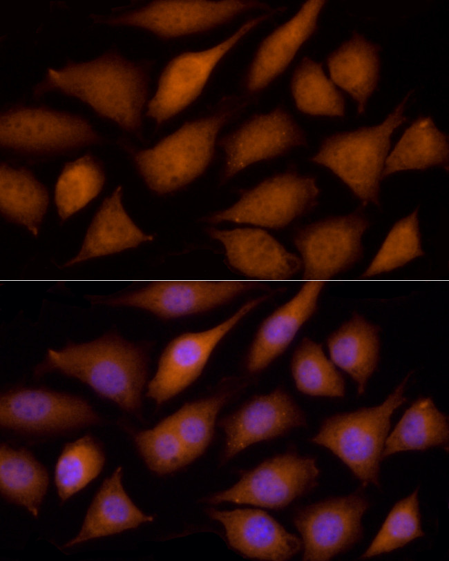 ECSIT Antibody in Immunocytochemistry (ICC/IF)