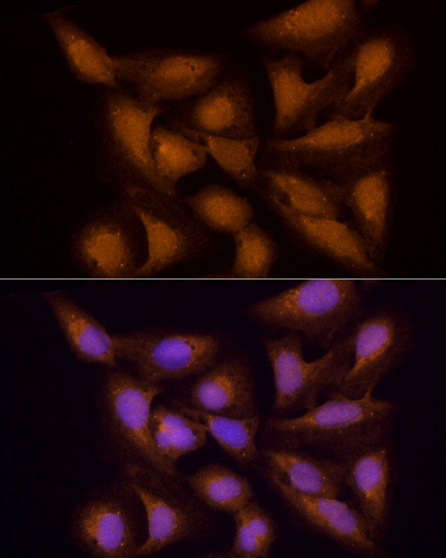 ECSIT Antibody in Immunocytochemistry (ICC/IF)