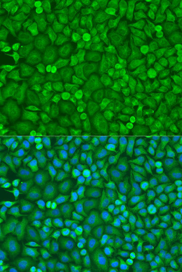 eIF4E Antibody in Immunocytochemistry (ICC/IF)