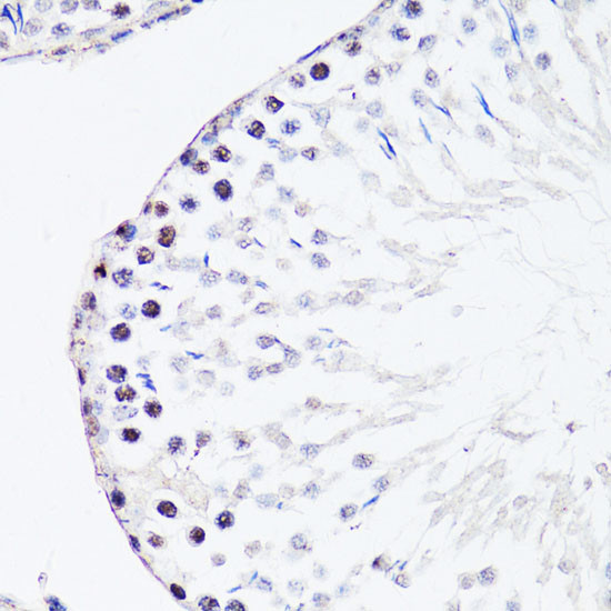 FGF12 Antibody in Immunohistochemistry (Paraffin) (IHC (P))