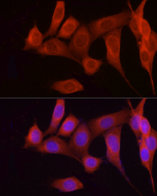 FGF17 Antibody in Immunocytochemistry (ICC/IF)