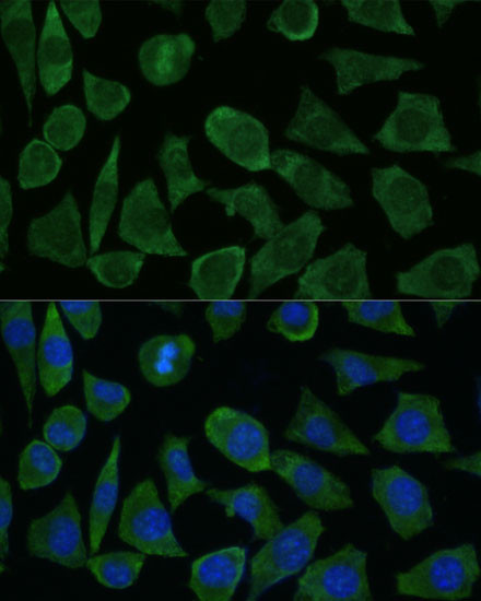 FKBP1B Antibody in Immunocytochemistry (ICC/IF)