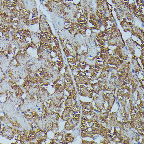 FKBP1B Antibody in Immunohistochemistry (Paraffin) (IHC (P))