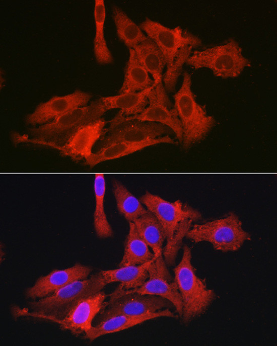 G6PC3 Antibody in Immunocytochemistry (ICC/IF)