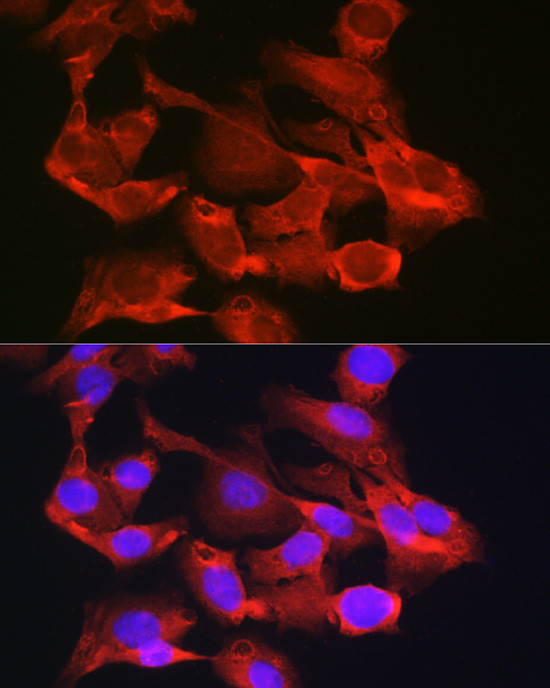 G6PC3 Antibody in Immunocytochemistry (ICC/IF)