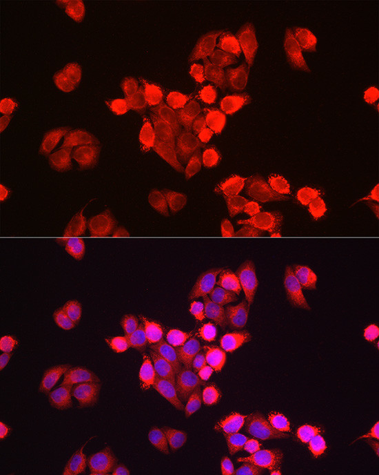 GALC Antibody in Immunocytochemistry (ICC/IF)